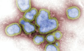 Ministro da Saúde diz que coronavírus pode chegar em breve à Irlanda