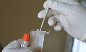 Irlanda ultrapassa os 50 mil casos do novo coronavírus